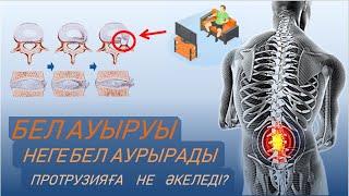 ПРОТРУЗИЯ,БЕЛ АУЫРУЫ I Себептері,Симптомдары I ПРОТРУЗИЯНЫҢ  белгілері