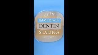 Immediate Dentin Sealing is necessary for biomimetic dentistry!