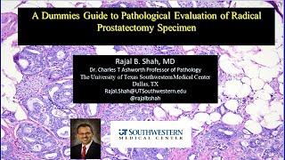 A Dummies Guide to Pathologic Staging of Prostate Cancer (Radical Prostatectomy Specimen)