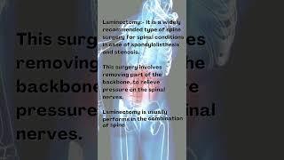 What is Laminectomy? | Spine Surgery Explained by Dr. Ravi Shankar ‍️