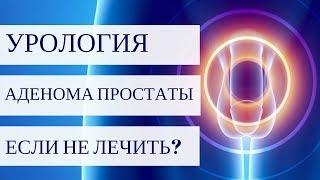 АДЕНОМА ПРОСТАТЫ - что будет, если не лечить?