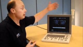 Medison Sonovet R3 veterinary portable ultrasound system video from BCF Technology