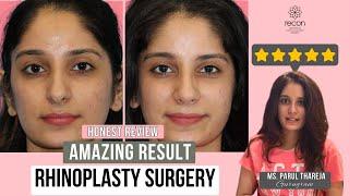 My Rhinoplasty Journey with Dr Pragati Shubha