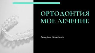 Дисфункция ВНЧС / лечение, что после капы