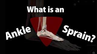 Visible Body | 3 Ankle Sprain Symptoms