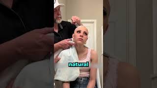 She had to cut her hair off because of her condition 