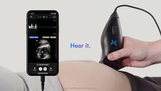 Butterfly It: OB/GYN Ultrasound