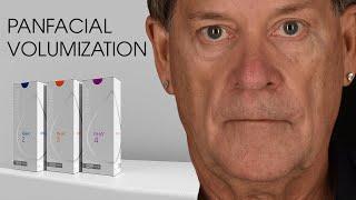 RHA® Collection Fillers for Panfacial Volumization with Dr. Kian