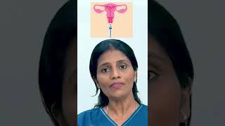 Embryo Transfer Procedure | Jeevan women care