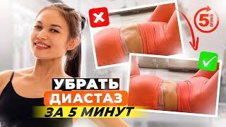 УПРАЖНЕНИЯ ДЛЯ ПЛОСКОГО ЖИВОТА ПРИ ДИАСТАЗЕ НА КАЖДЫЙ ДЕНЬ