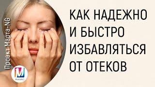 Как НАДЕЖНО и БЫСТРО избавляться от отеков | Марта Николаева-Гарина