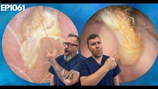 EAR INFECTION REMOVAL AND NERVOUS CHILDS EAR WAX REMOVAL - EP1061