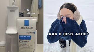 КАК Я ЛЕЧУ АКНЕ?‍️ МОЯ УХОДОВАЯ КОСМЕТИКА для лица и тела