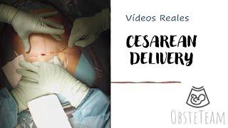 CESAREAN DELIVERY / C-SECTION