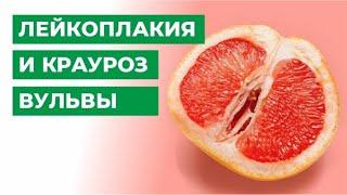 Лейкоплакия и крауроз вульвы. Что делать и как лечить?