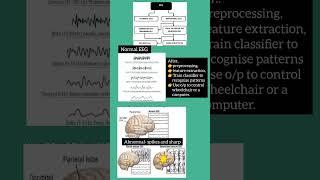 EEG Signals Normal & Abnormal #eeg #bci #ai #education #normal #abnormal #viralshorts