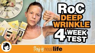 The Return of The RoC! Deep Wrinkle 4 Week Test - THIS IS REAL LIFE