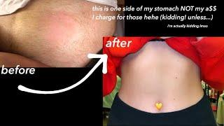 HOW I REMOVE UNWANTED BODY HAIR (STOMACH AND BACK)