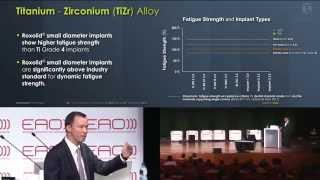 EAO 2014 in Rome - Straumann Corporate Forum - Stephen Chen