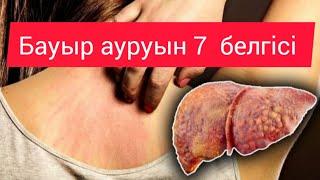 Бауыр қалай ауырады. Бауыр ауруын 7 белгісі . бауыр ауруын белгілері