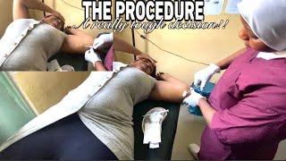 Getting IMPLANON (Contraceptive) barely 2months After Birth!..The Advantages and side effect | Vlog