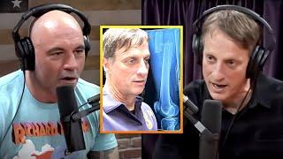 Joe Rogan | Tony Hawk Discussing His Wildest Injuries!