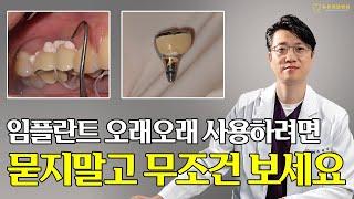 [부산전체임플란트] 구강내에 시멘트가? 임플란트 유지관리가 제일 중요한 이유 ?!