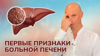 Как понять, что ПЕЧЕНЬ не здорова? Складка на лбу. Лечение в домашних условиях