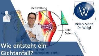 Gicht  Oft unterschätzt aber sehr schmerzhaft: Akuter Gichtanfall - Ursachen, Symptome & Therapie