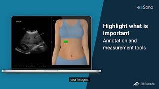 Explore e Sono, the new Ultrasound Software Simulator from 3B Scientific