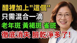 醋裡加「這個」一滴，老人斑、黃褐斑、雀斑2週內淡化消失不見！醫生推薦真正有效的臉部斑點管理法。