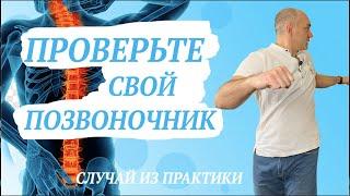 Интересный случай во время одной из консультаций. Прострелы в пояснице.ПРОВЕРЬТЕ свой позвоночник!