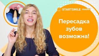 Аутотрансплантация зуба в стоматологии – как это реализовано?