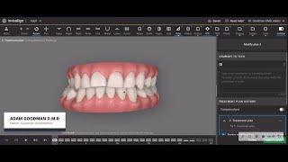 The unforeseen consequences of removing four premolars for orthodontic treatment