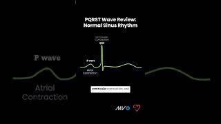 Quick Review of PQRST Waves 〰️〰️