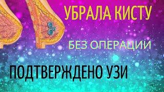 ИЗБАВИЛАСЬ ОТ КИСТЫ В ГРУДИ БЕЗ ОПЕРАЦИИ. ПОДТВЕРЖДЕНО УЗИ