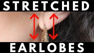 HELP! What to do for Stretched Earlobes?!