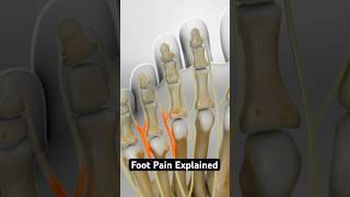 What is causing your foot pain? (3D Animation)