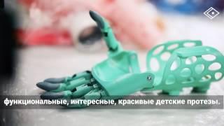 Детские протезы рук от «Моторики»