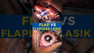 Flap V/S Flapless Lasik