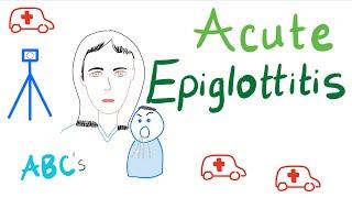 Acute Epiglottitis | Causes, Symptoms, Diagnosis and Management