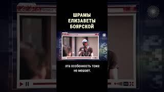 Откуда шрамы у Боярской #shorts