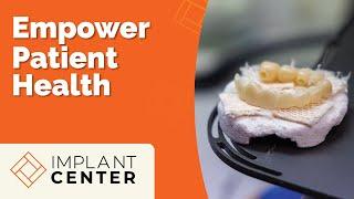 Implant Center of Miami: How Dental Labs Services Empower Patient Health