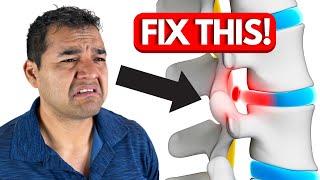 3 Quick Exercises To Begin To Heal A Herniated Disc Without Surgery