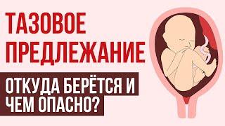 Тазовое предлежание плода: причины, диагностика, способ родоразрешения