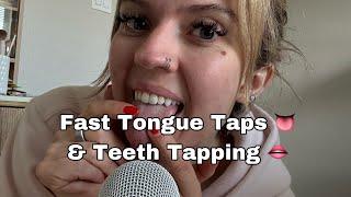 ASMR| No Talking, Fast/Dry & Wet Mouth Sounds- Teeth & Tongue Tapping