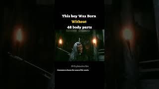 This boy Was Born Without 48 body Parts | Dororo Movie Explained in English #shorts