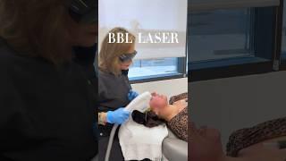 Solutions for treating #redness #rosacea #sundamage #acne #aging and more! #bbllaser