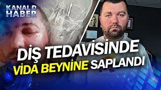 Bursa'da Akılalmaz Olay: Diş Tedavisinde Vida Beynine Saplandı! #Haber