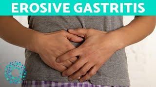 EROSIVE GASTRITIS - Belly Pain And Vomiting